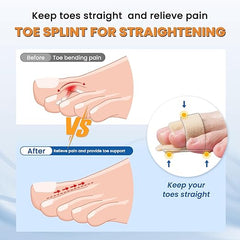 Add One More Set of Hyggear™ Hammer Toe Straightener For A Better Price