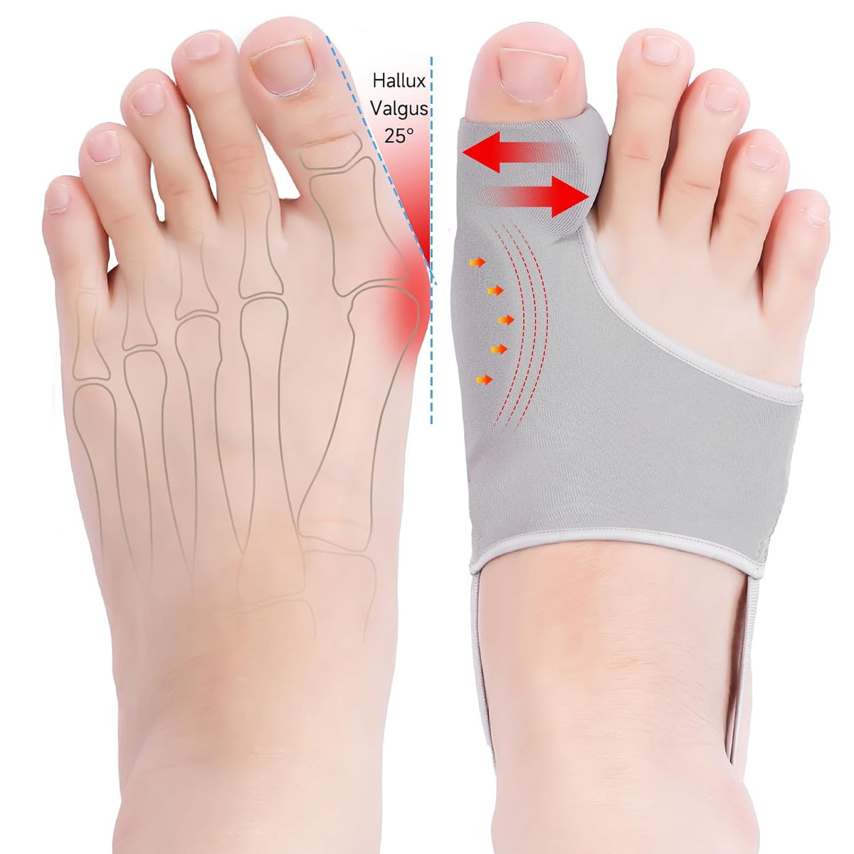 Adjustable Toe Separators - Soft, Breathable Polyester Separator Pads with Buckle Closure, Original Design for Comfortable Shoe Wear, Hand Wash Only, Shoe Separators, Comfortable Footwear, Secure Fit, Durable Construction - 432875439